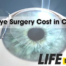 laser-eye-surgery-cost-in-canada-the-complete-guide-laser-eye-surgery-cost-in-canada-the-complete-guide