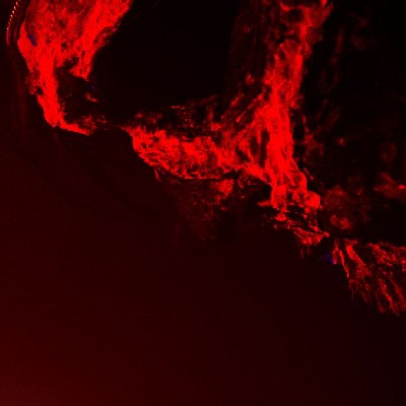 Mr. Maggot - Featured At Planetmosh Spotify Playlist For October 2020
