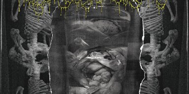Copenhagen Death Grind Unit SEQUESTRUM (members of CHAOTIAN and UNDERGANG) to Release "Pickled Preservation" EP