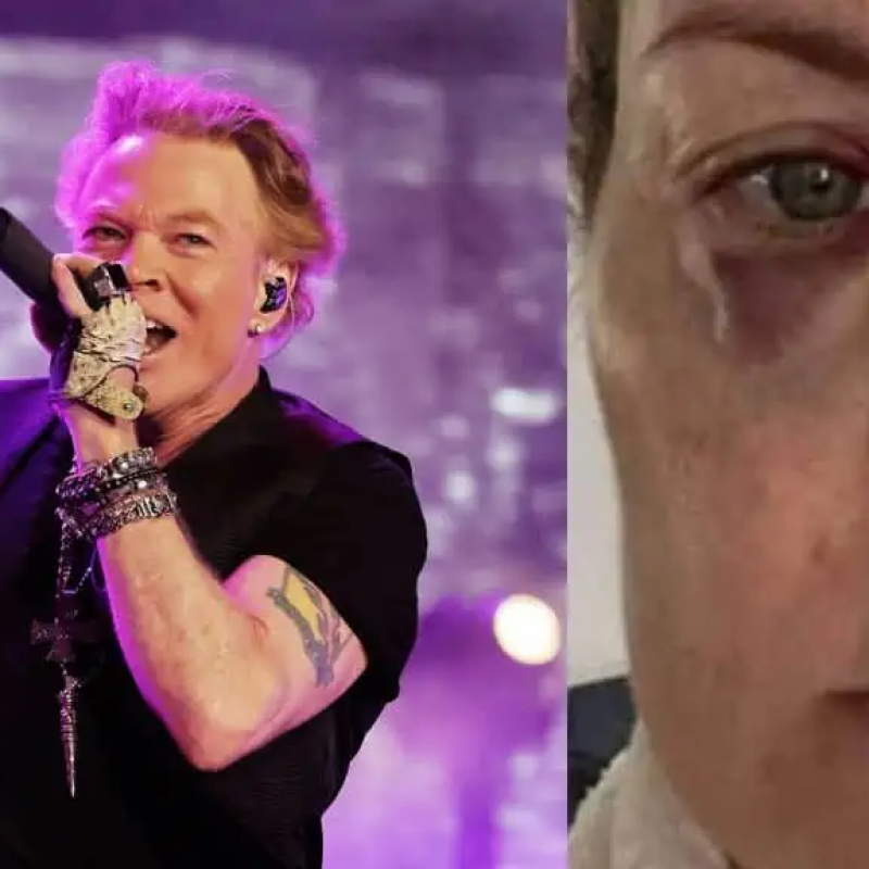 Woman Injured At GUNS N’ ROSES Show After AXL ROSE Threw Mic At Her