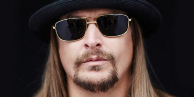 KID ROCK CALLED OUT