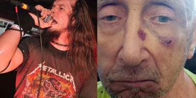 Ex Anthrax Singer Arrested for Assaulting Two Elderly Men