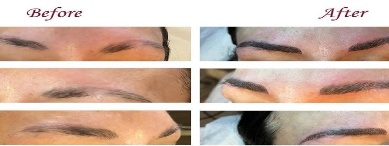 Arizona Studio of Electrolysis