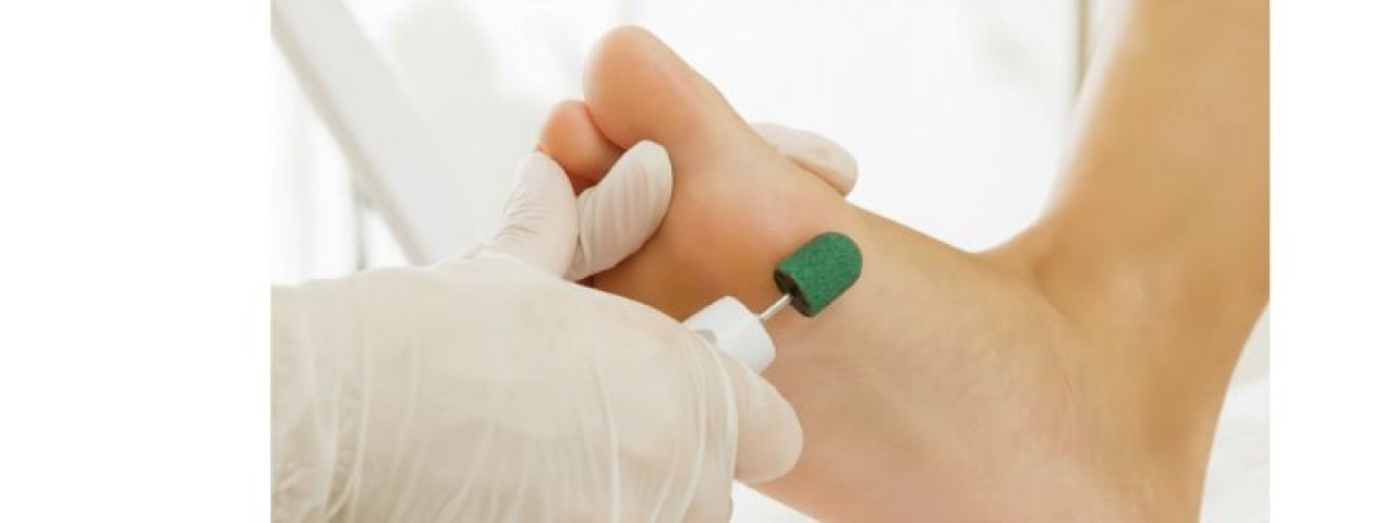 curafoot