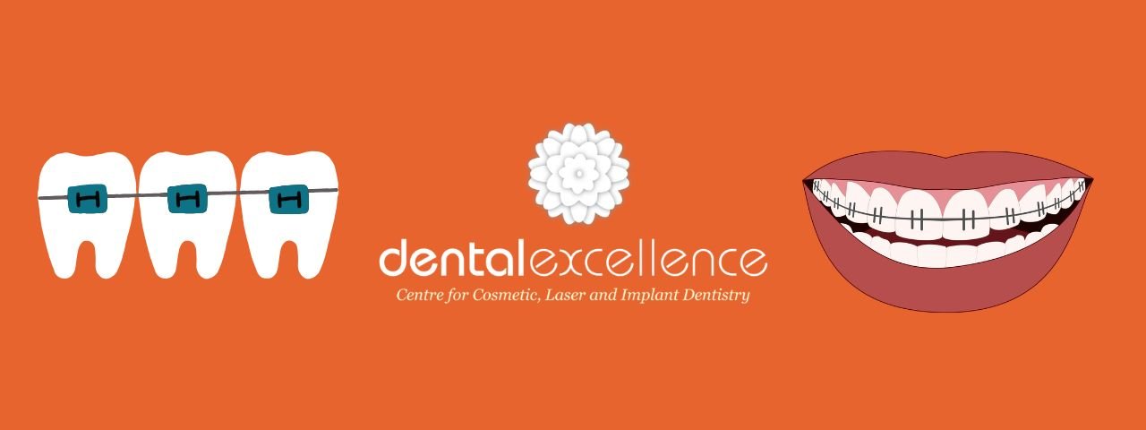dentalbracesadelaide