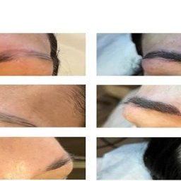 Arizona Studio of Electrolysis