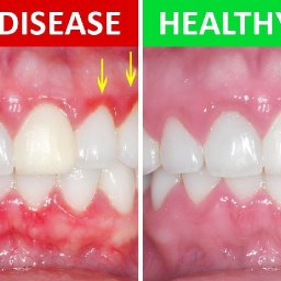 Bright Gum