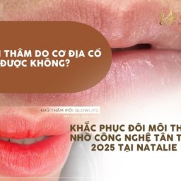 moi-tham-do-co-dia-co-tri-duoc-khong-khac-phuc-doi-moi-tham-nho-cong-nghe-tan-tien-2025-tai-nat