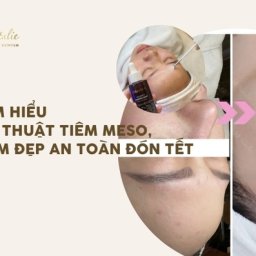 tim-hieu-ky-thuat-tiem-meso-lam-dep-an-toan-don-tet