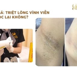giai-ma-triet-long-vinh-vien-co-moc-lai-khong