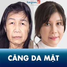 cang-da-mat-gia-bao-nhieu-tien-uoc-bao-lau-quy-trinh