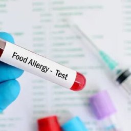 unveiling-the-importance-of-food-intolerance-and-allergy-tests-zupyak