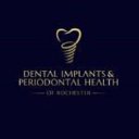 Dentalimplantsperiodontal